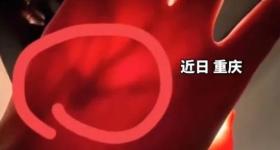 女生晒照被网友提醒有“瘤”？真的救命了！医生回应……