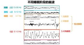 睡不着时闭目养神，有休息效果吗？