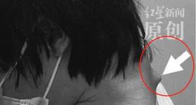 男子长期窝在屋里玩手游，脖子长角，抬不起头