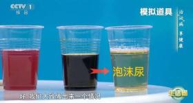 喝水后4个异常 可能是肾发出的“求救信号”