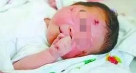 厦门车祸奇迹宝宝亲属因赔偿款反目 孩子五年来首次见到外婆