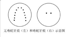 专家：毒蛇咬伤牙痕通常为2个，被咬后尽量记清蛇特征或拍照