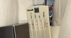 顾客在酒店洗漱包内发现用过的HIV检测盒，华住回应