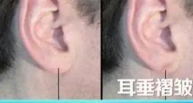 血管不好，从脸上能看出来！警惕→