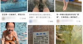 泡脚“鱼疗”后，她被截掉了5个脚趾！这5类人不要随意尝试