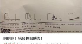 传染性极强！多人确诊“疱疹侠”，疾控紧急提醒