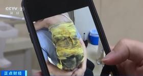 夏季高发儿童烫伤 处理不当或致严重感染