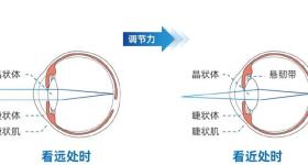 @看手机的你 当心患上“视频终端综合征”
