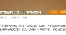 脖子总是黑黑的洗不干净？别大意，这可能是身体在“求救”！