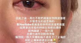 突然爆炸！女演员自曝：眼球差点炸破，痛到大哭……千万别学
