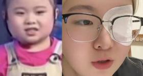 25岁女星宣布确诊，右眼失明！