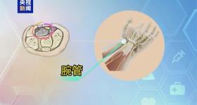 “鼠标手”被纳入职业病！别等肌肉萎缩才重视，医生提醒→