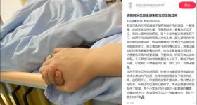 疑打水仗后感染“食脑虫”，6岁男孩君君去世