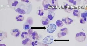 痛心！两名幼童相继离世，紧急提醒