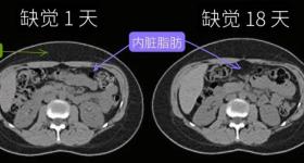 注意！缺觉，可能会让肚子长胖