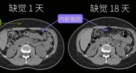 这样睡觉，真的能减肥！